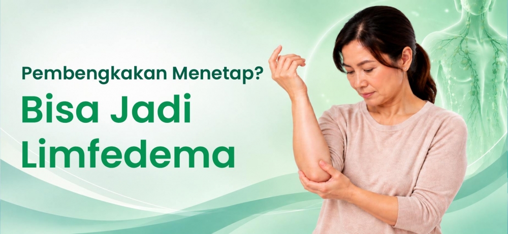 Limfedema: Ketika Pengobatan Konservatif Mungkin Tidak Lagi Cukup