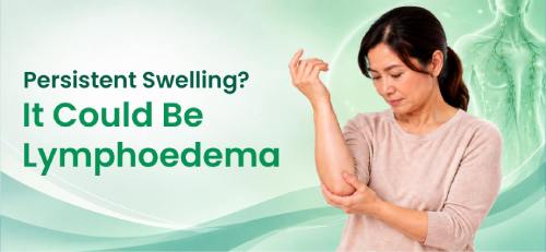 Lymphoedema: When Conservative Treatment May Not Be Enough