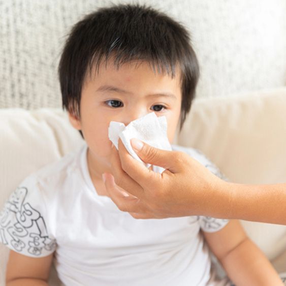 Sinusitis (Infeksi Sinus)