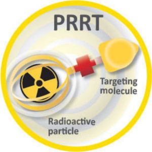 Targeted Radionuclide Therapy