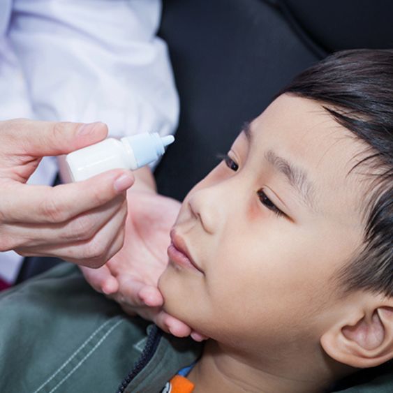 Konjungtivitis (Mata Merah):