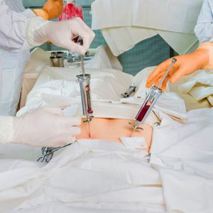 Bone Marrow Transplant