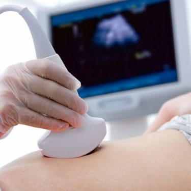 Ultrasound