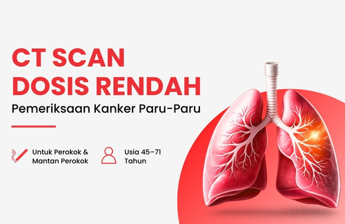 ZEISS SMILE Lasik (Biaya Pendaftaran)
